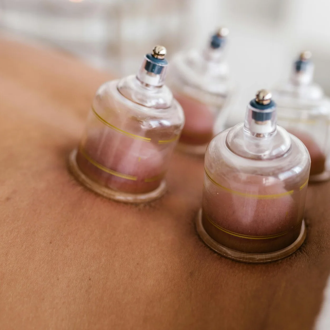 Schröpfen Hijama bei AYA Viva Zürich